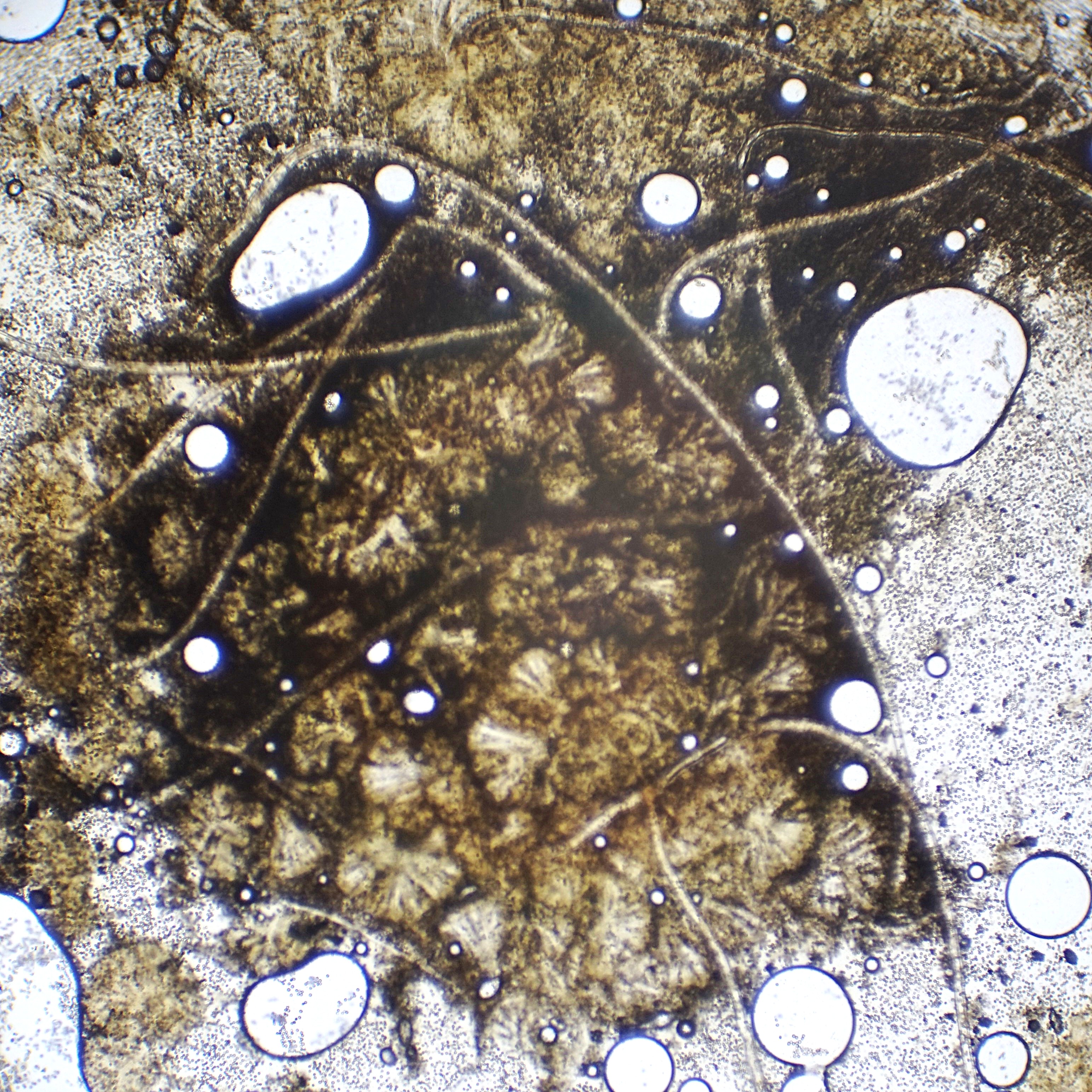 Zoom out of black mold