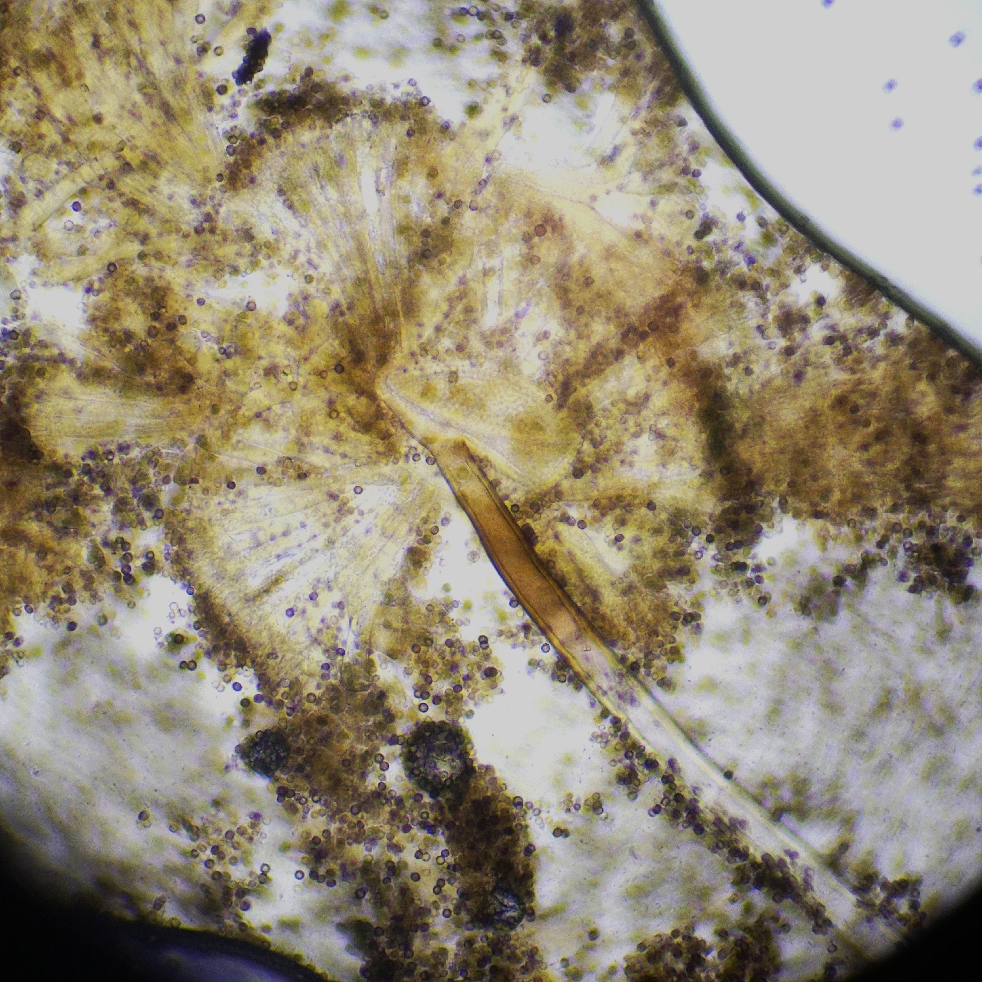 Cluster of spores and fungi of black mold