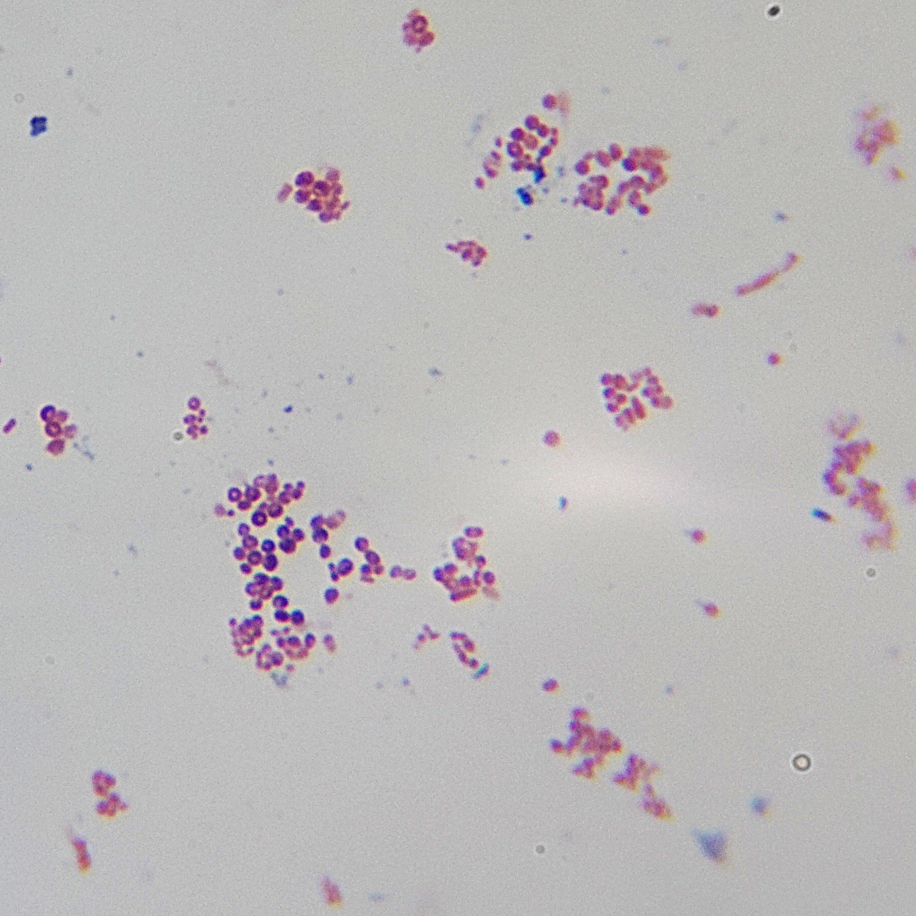 bacteria gram neg
